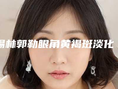 锡林郭勒眼角黄褐斑淡化安全度高不高